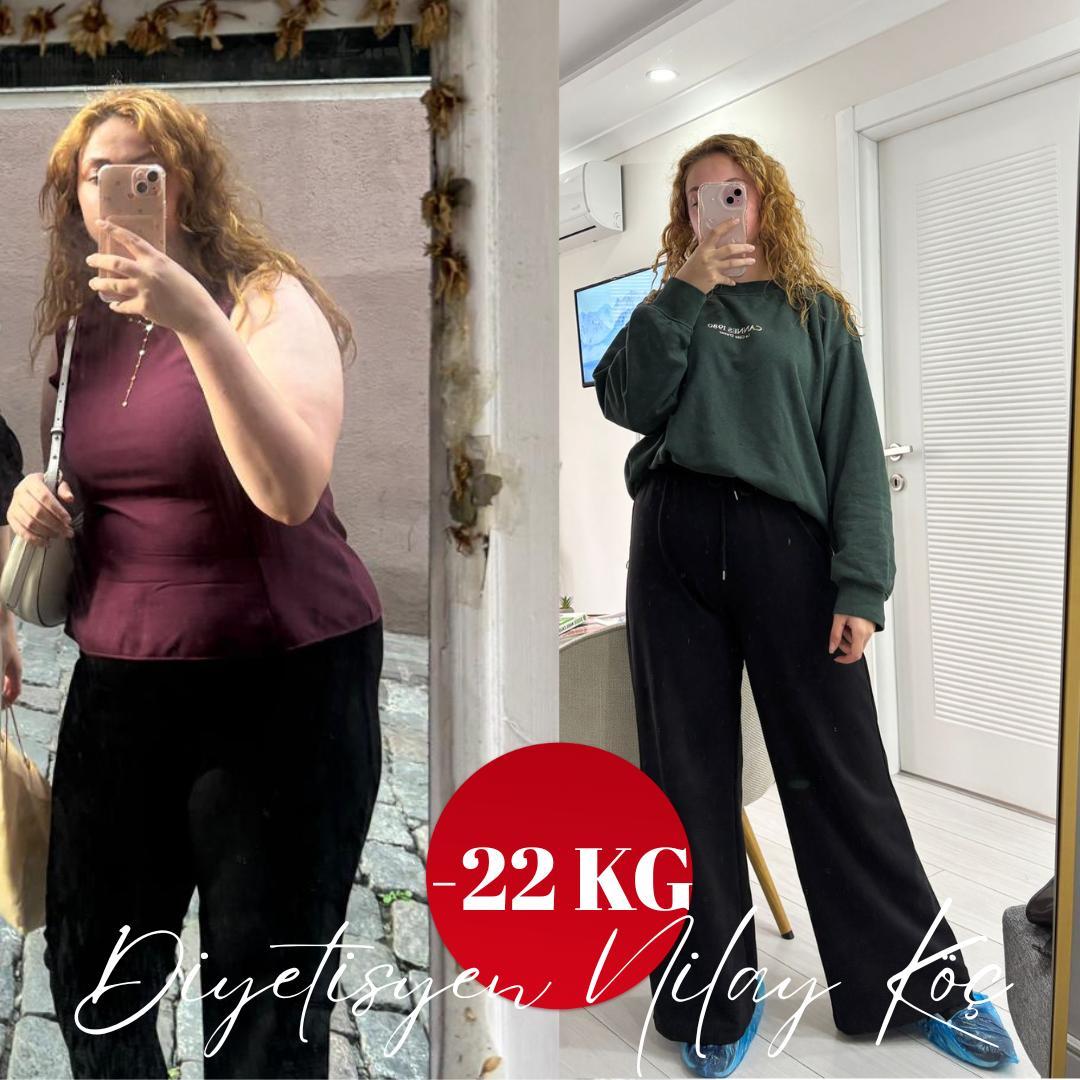 Bir danışanın önce ve sonra fotoğrafları; görselde 22 kg kayıp belirtiliyor